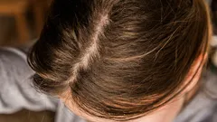 Mastné vlasy: 7 praktických tipů, jak si udržet efekt čerstvě umytých vlasů