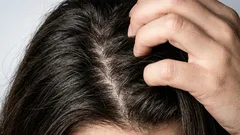 Jak se doma svépomocí zbavit mastných vlasů